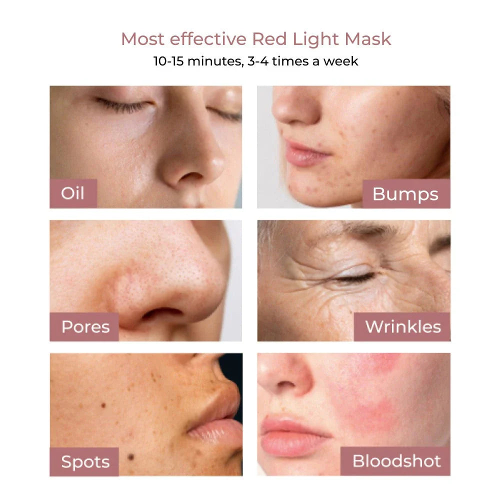 ARAL Beauty 100-LED Light Therapy Mask